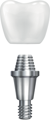 implant diagram