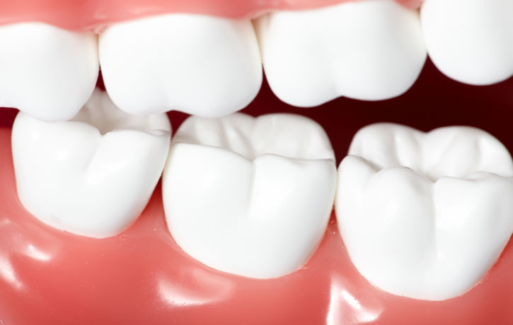 Bone Grafting Torrance, CA